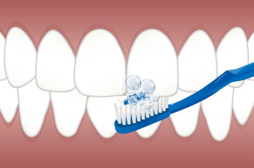 Tři nejčastější důvody, proč se kazí zuby
